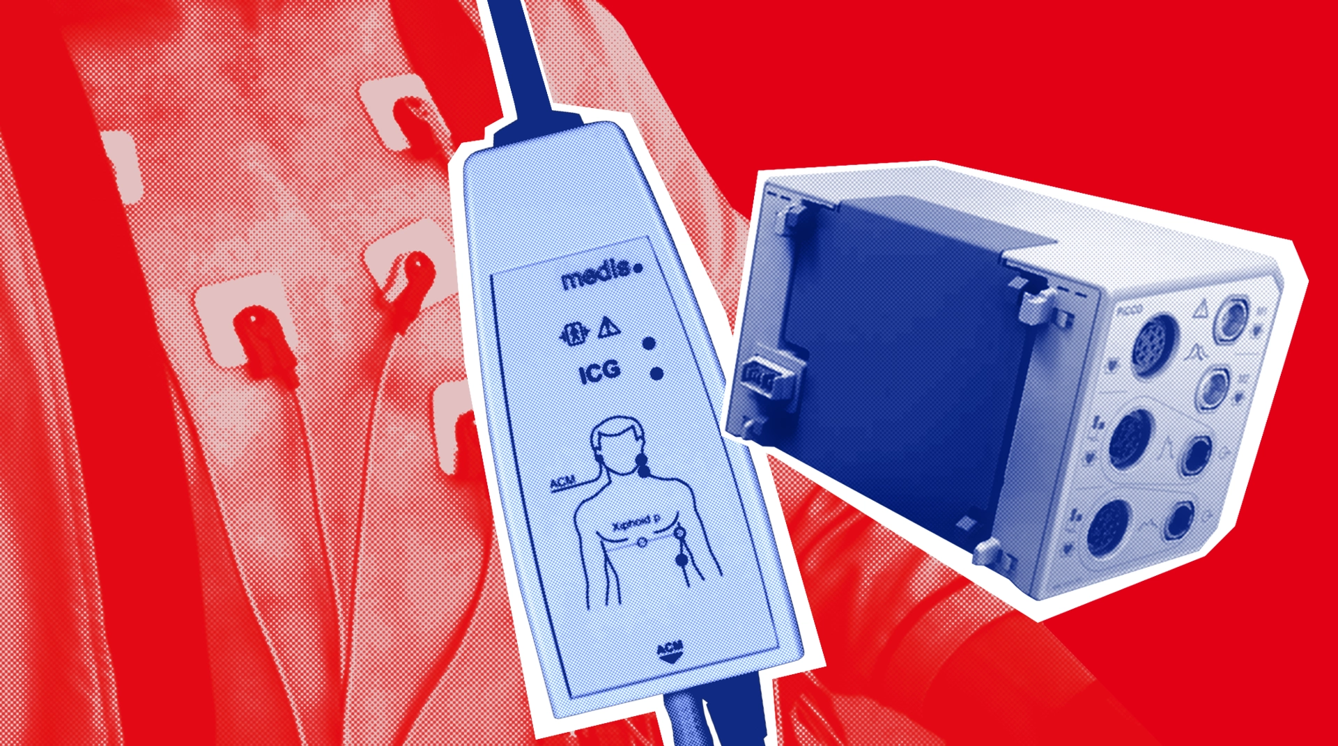 Что такое гемодинамика: сравниваем методы мониторинга