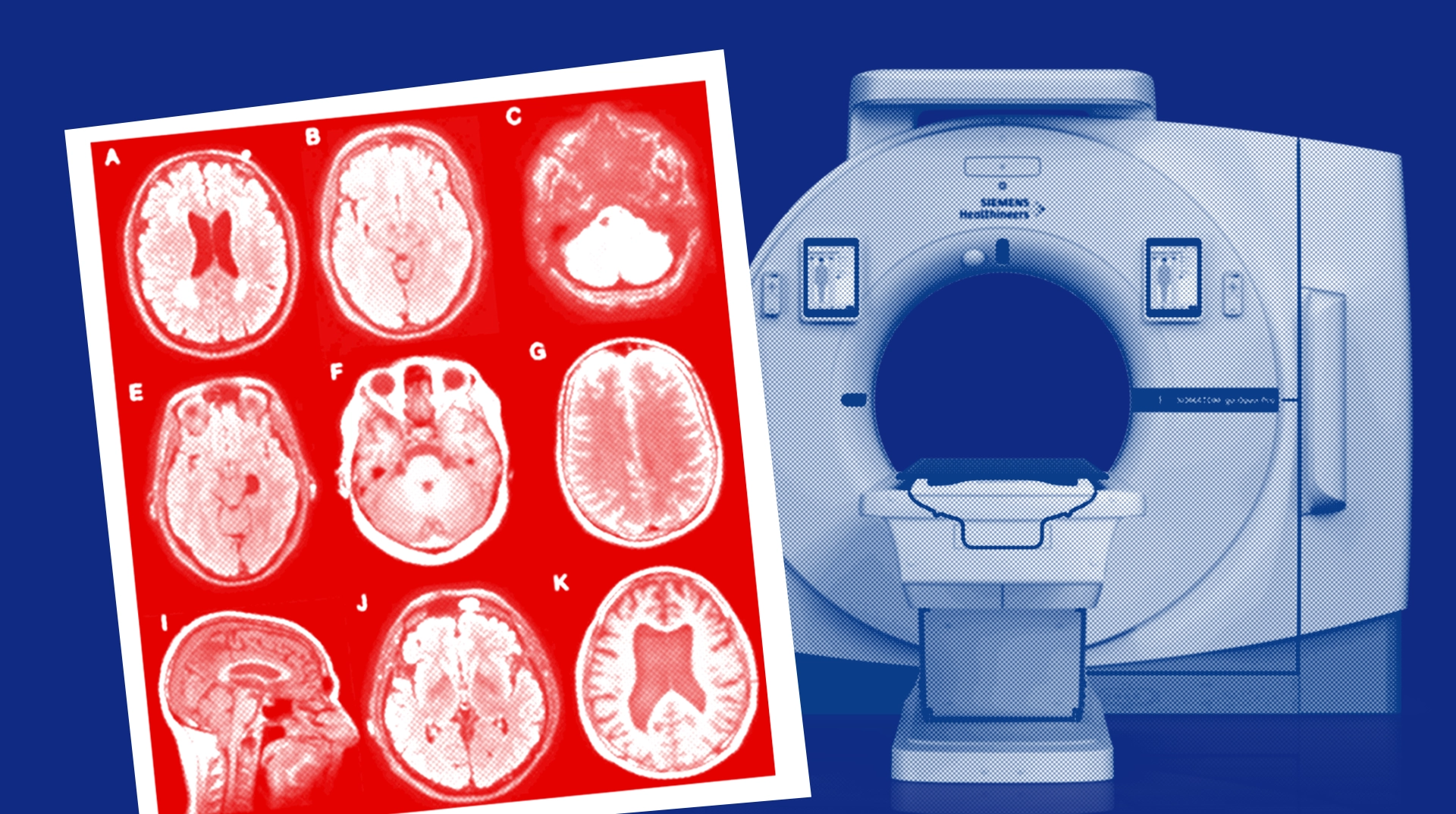 Все о компьютерной томографии: назначение, виды, результаты