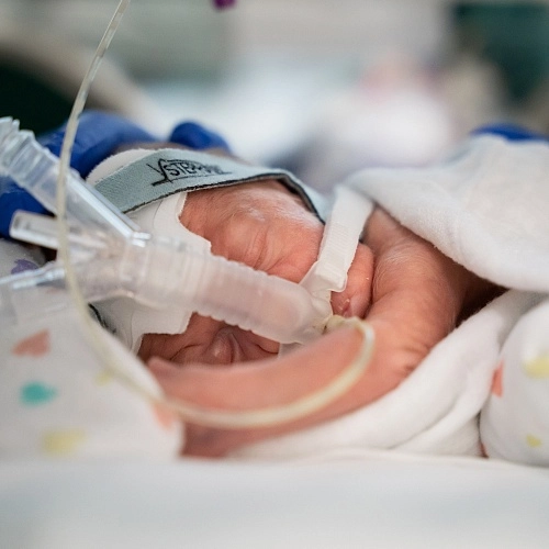 Аппарат ИВЛ Stephan Sophie неонатальный