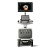 Аппарат УЗИ Philips EPIQ 7 от Philips фотография