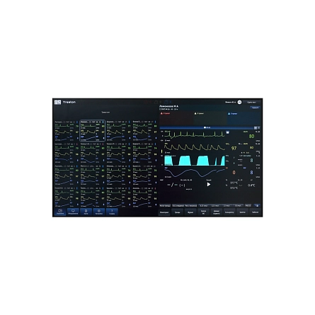 Система централизованного мониторинга СЦМ «Тритон» от TRITON фотография