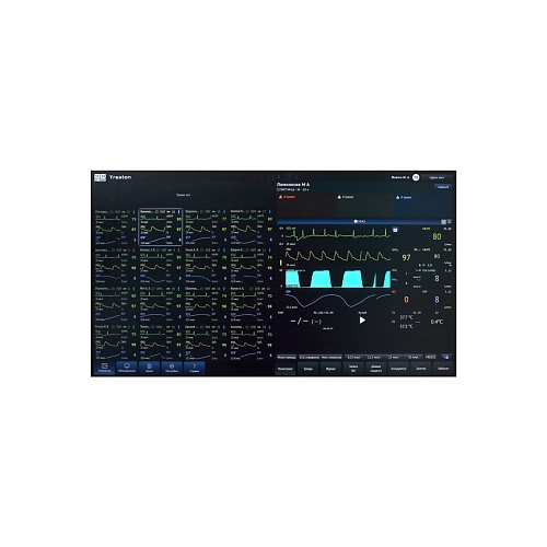 Система централизованного мониторинга СЦМ «Тритон»