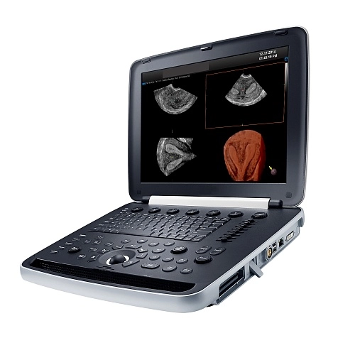 Аппарат УЗИ Рускан70П