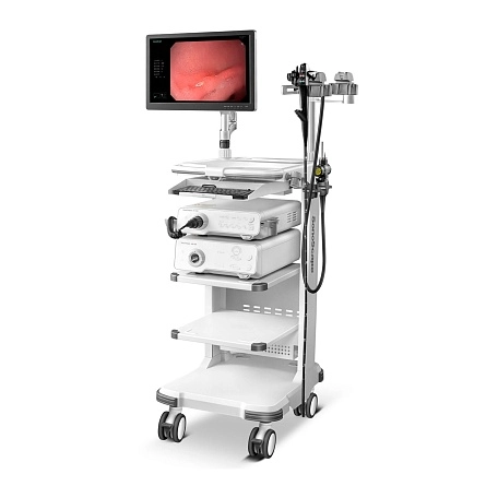 Видеоэндоскопическая система HD 350 от SonoScape фотография