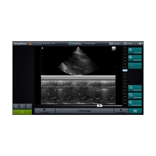 Портативный аппарат УЗИ СмартСкан 15