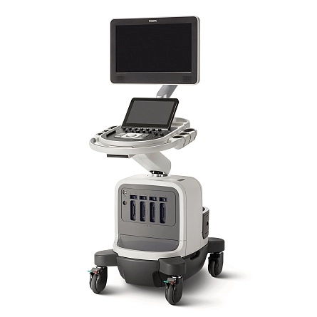 Аппарат УЗИ Philips Affiniti 30 от Philips фотография