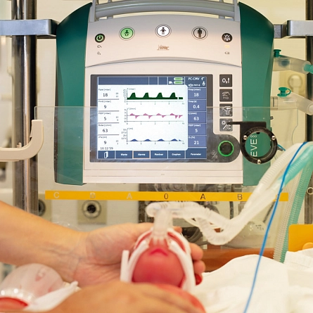 Аппарат ИВЛ Stephan EVE NEO неонатальный от Stephan фотография