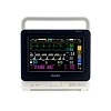 Монитор пациента Philips IntelliVue MX400 от Philips фотография