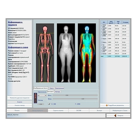 Остеоденситометр Stratos DR от DMS Imaging фотография