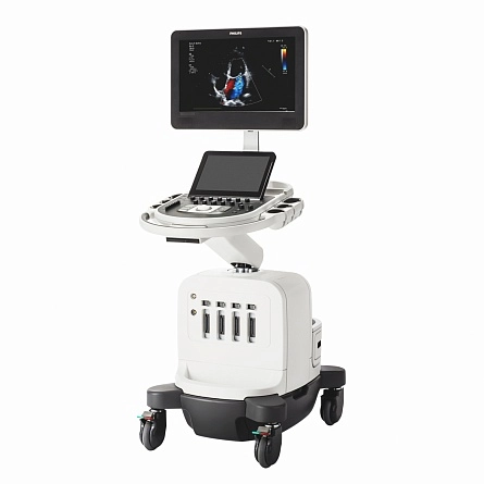 Аппарат УЗИ Philips Affiniti 50 от Philips фотография