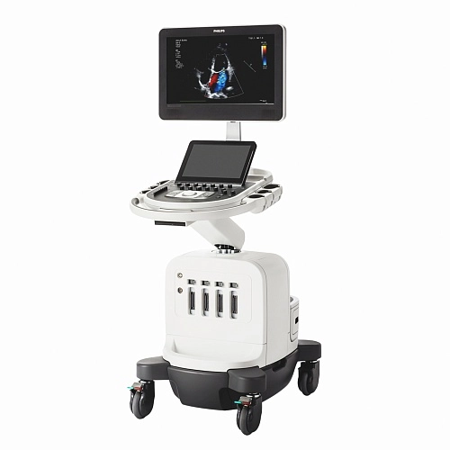 Аппарат УЗИ Philips Affiniti 50