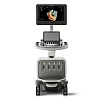 Аппарат УЗИ Philips EPIQ Elite от Philips фотография