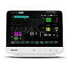 Монитор пациента Biolight AnyView M12 от Biolight фотография