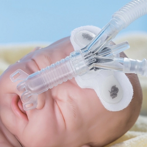 Интерфейс Stephan EasyFlow nCPAP для НИВЛ