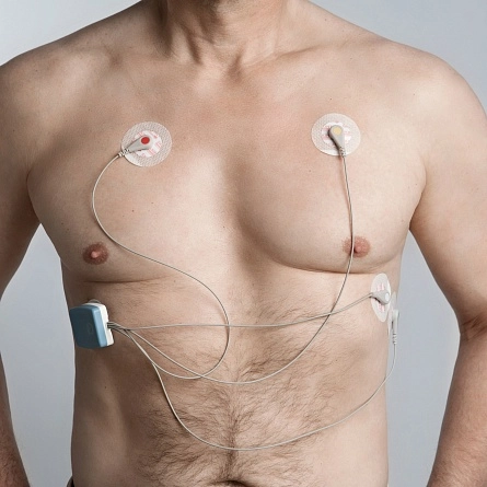 ПАК мониторинга ЭКГ Vitappio Кардисенс-2 от Vitappio фотография