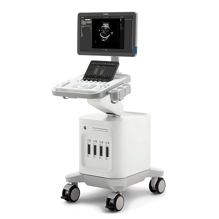 Аппарат УЗИ Philips 3300 от Philips фотография