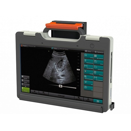Портативный аппарат УЗИ СмартСкан 15