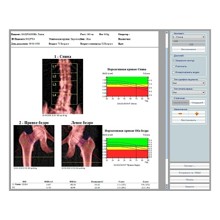 Остеоденситометр Stratos DR от DMS Imaging фотография