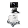 Аппарат УЗИ Philips EPIQ 5 от Philips фотография