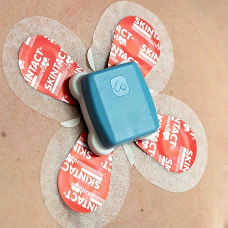 ПАК мониторинга ЭКГ Vitappio Кардисенс-1 от Vitappio фотография