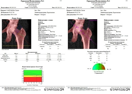 Остеоденситометр Stratos DR от DMS Imaging фотография