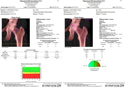 Остеоденситометр Stratos DR
