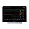 Монитор пациента Philips IntelliVue MX700 от Philips фотография