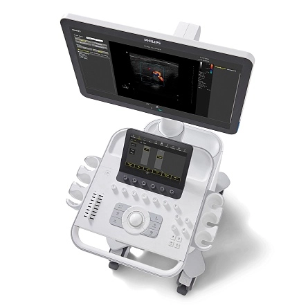 Аппарат УЗИ Philips 3300 от Philips фотография