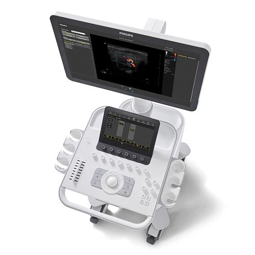 Аппарат УЗИ Philips 3300