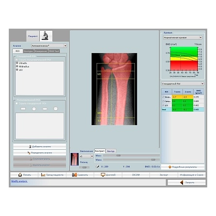 Остеоденситометр Stratos DR от DMS Imaging фотография