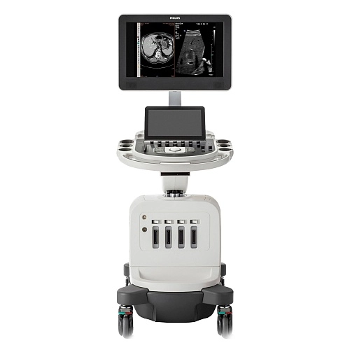 Аппарат УЗИ Philips Affiniti 50