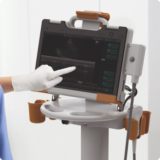 Смартскан на стойке