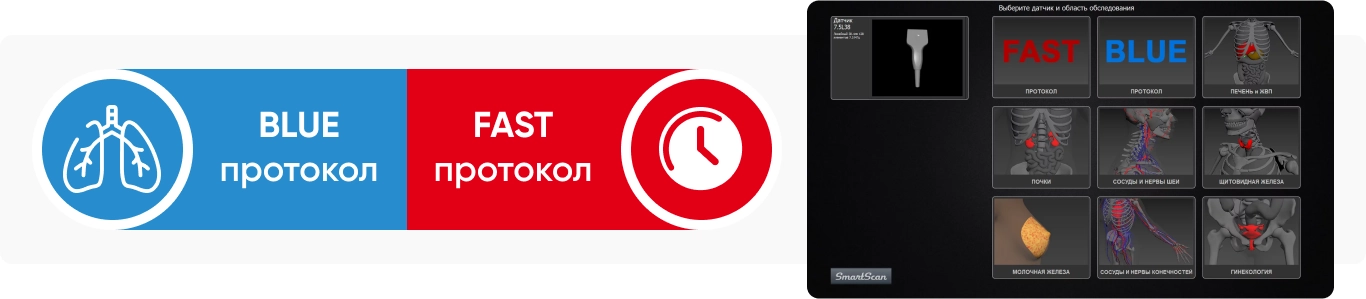 Неотложная сонография