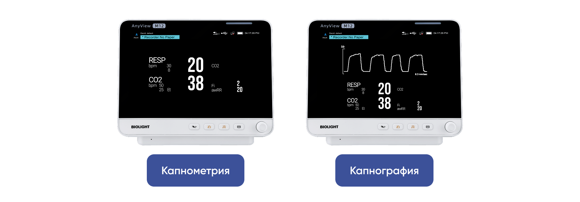 Сравнение результатов капнометрии и капнографии