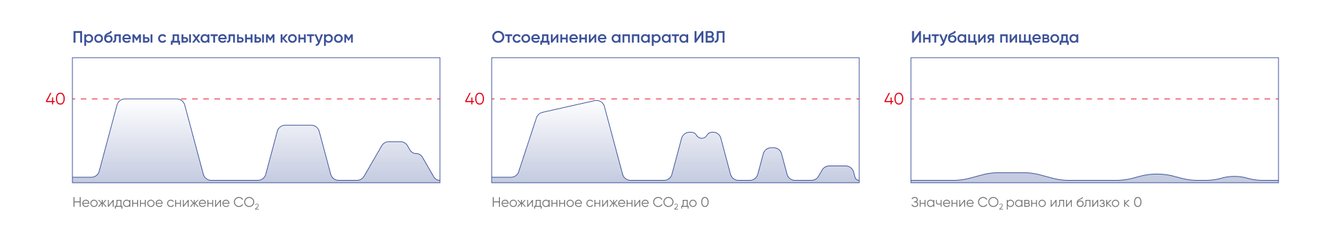 Форма капнограммы при возможных проблемах с дыхательным контуром