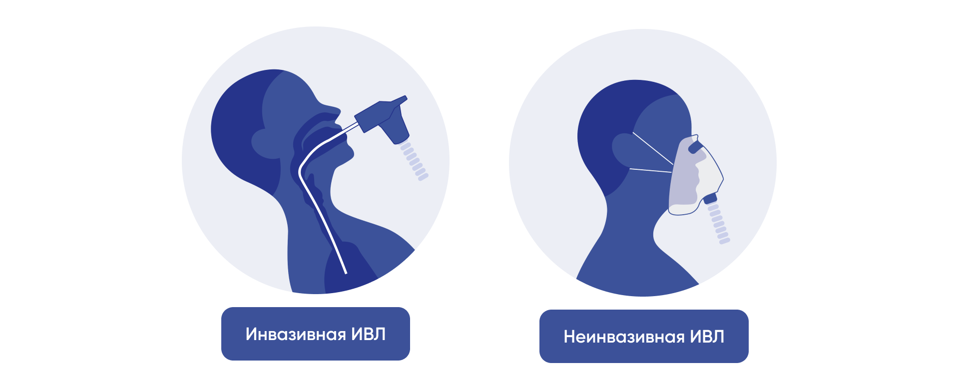 Инвазивная и неинвазивная ИВЛ