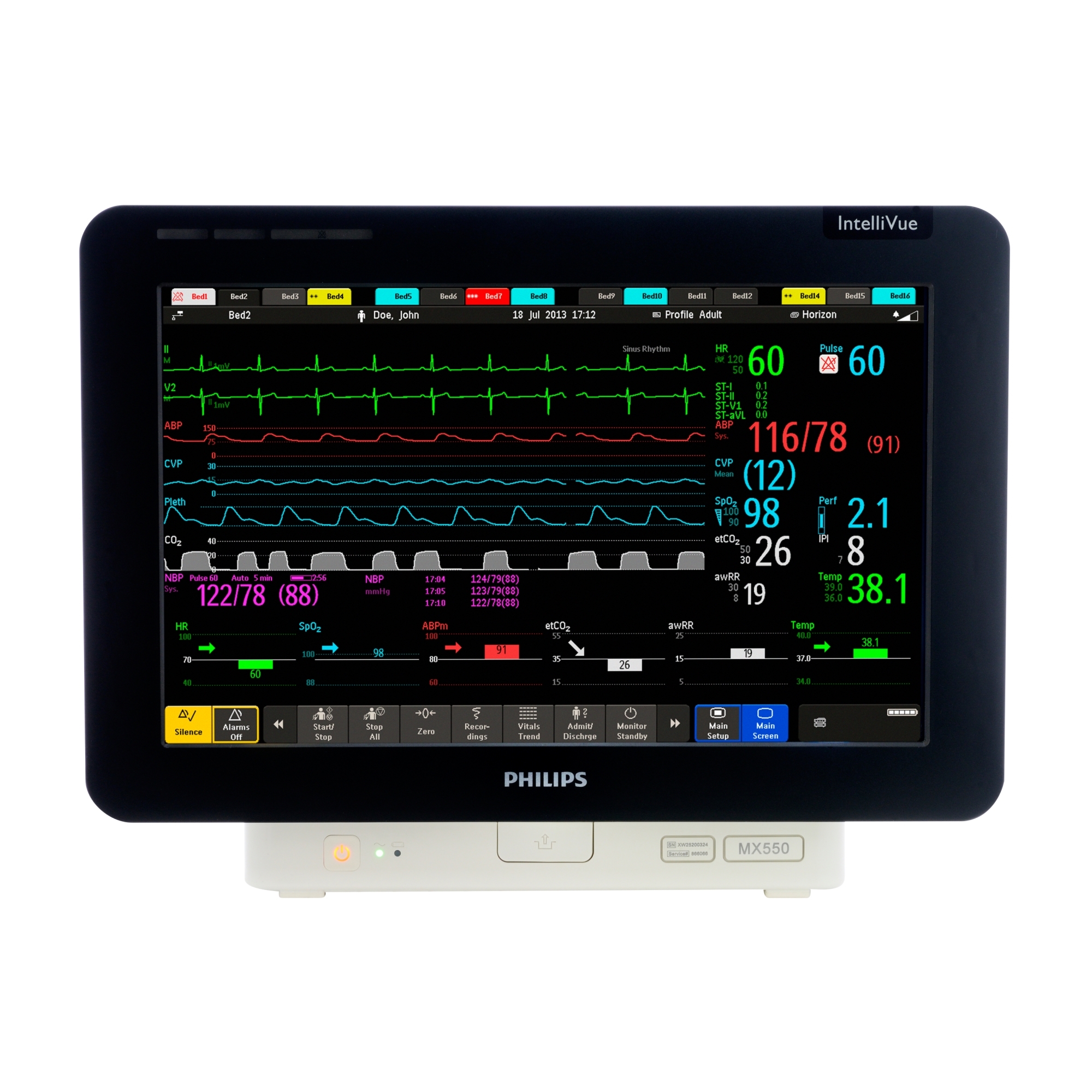 Монитор пациента Philips IntelliVue MX550
