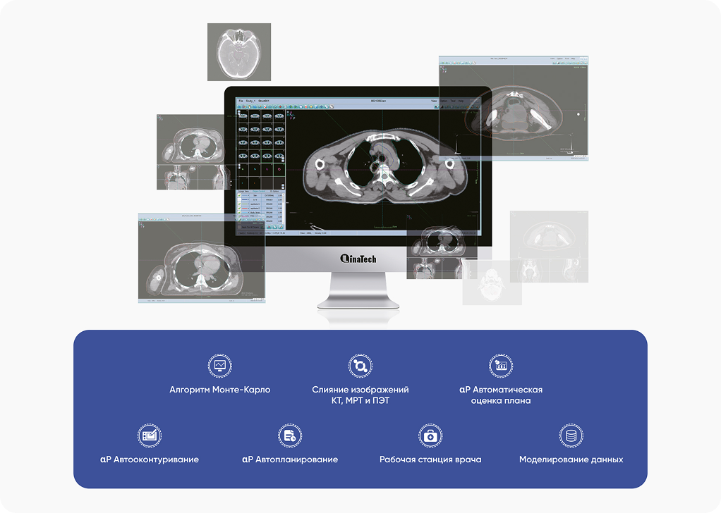 Система планирования лечения TiGRT TPS