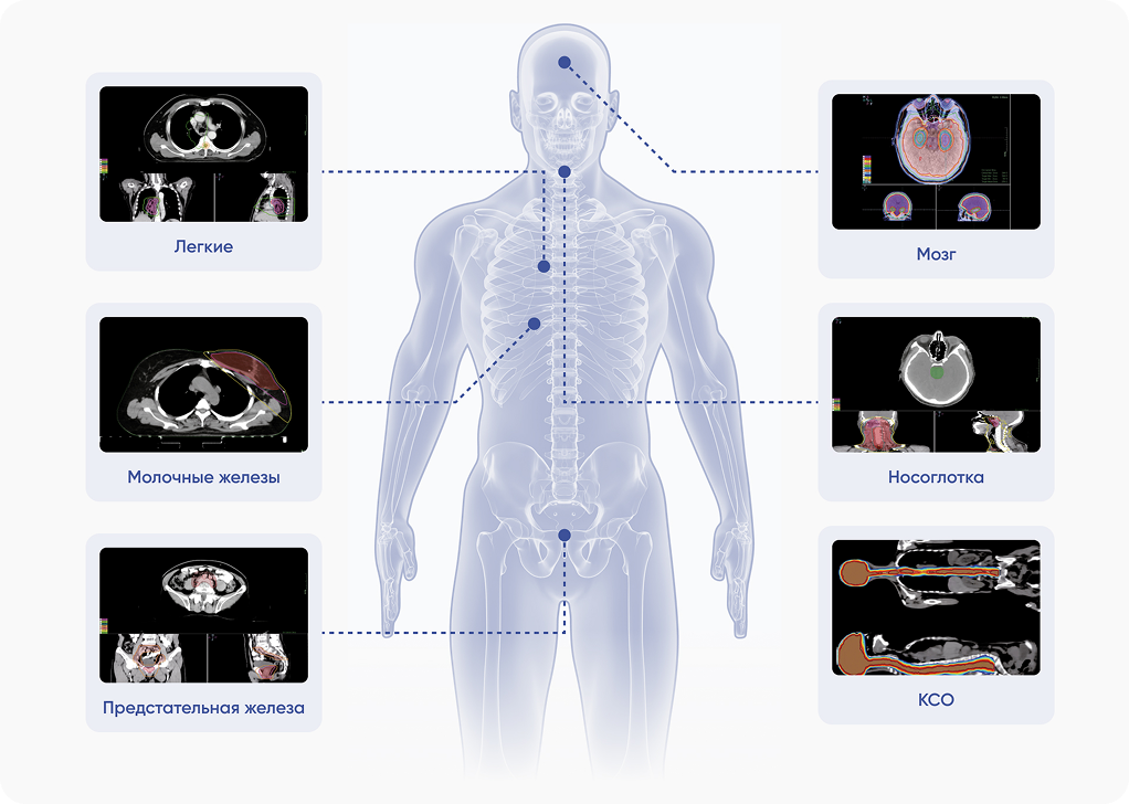 Лечение опухолей любой локализации