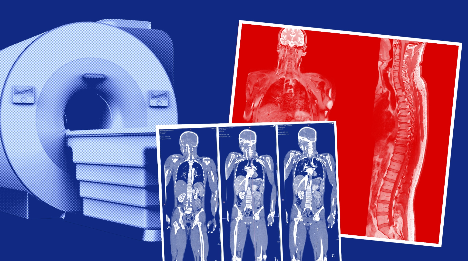 КТ и МРТ: в чем разница методов, какой из них лучше