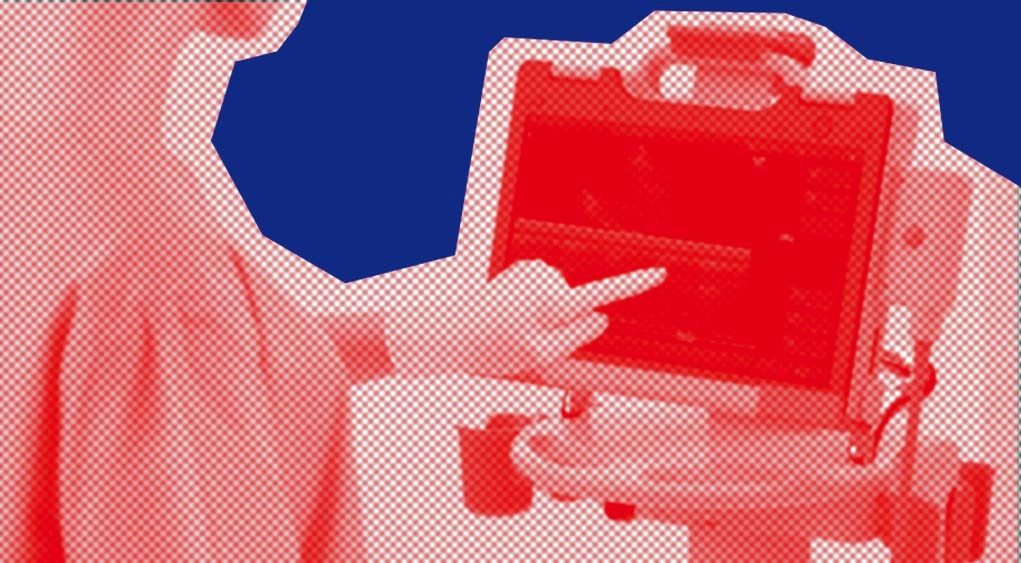 Что такое BLUE-протокол? Рассказываем про ургентную сонографию легких