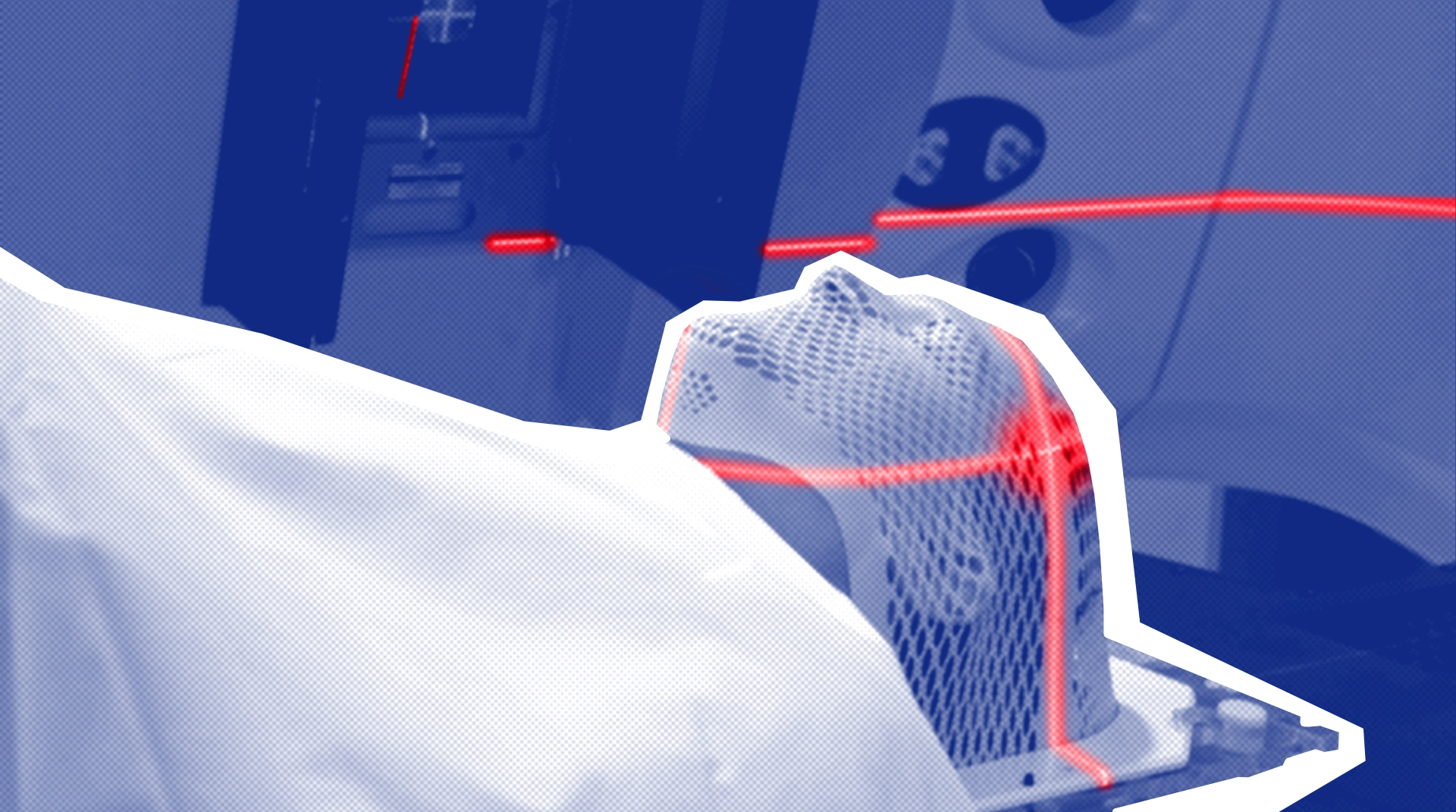 Лечение онкологии: методы облучения, виды лучевой терапии