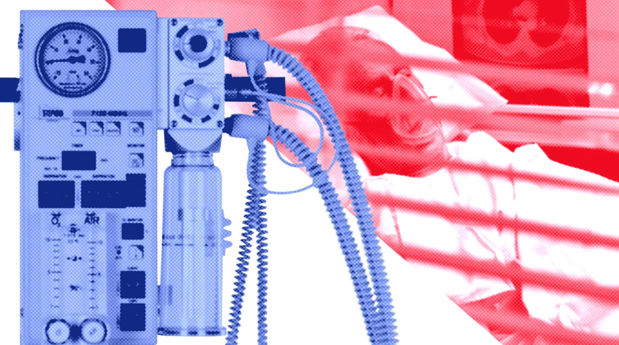 Как выбрать аппарат ИВЛ: советы для дилеров