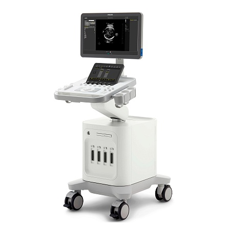 Аппарат УЗИ Philips 3300 смотреть фото на сайте trimm.ru Аппарат УЗИ Philips 3300 от Philips фотография